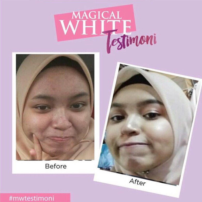 Magical White Skincare Original Set Gel Serum Dan Sakura Whitening Soap Kulit Cerah Glowing Tanpa Parut Jerawat Jeragat Shopee Malaysia