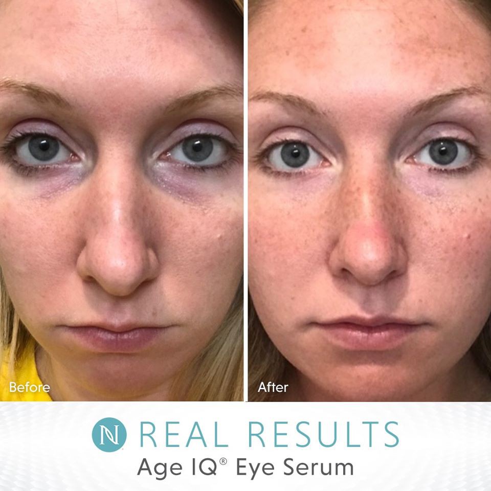 neora age iq eye serum