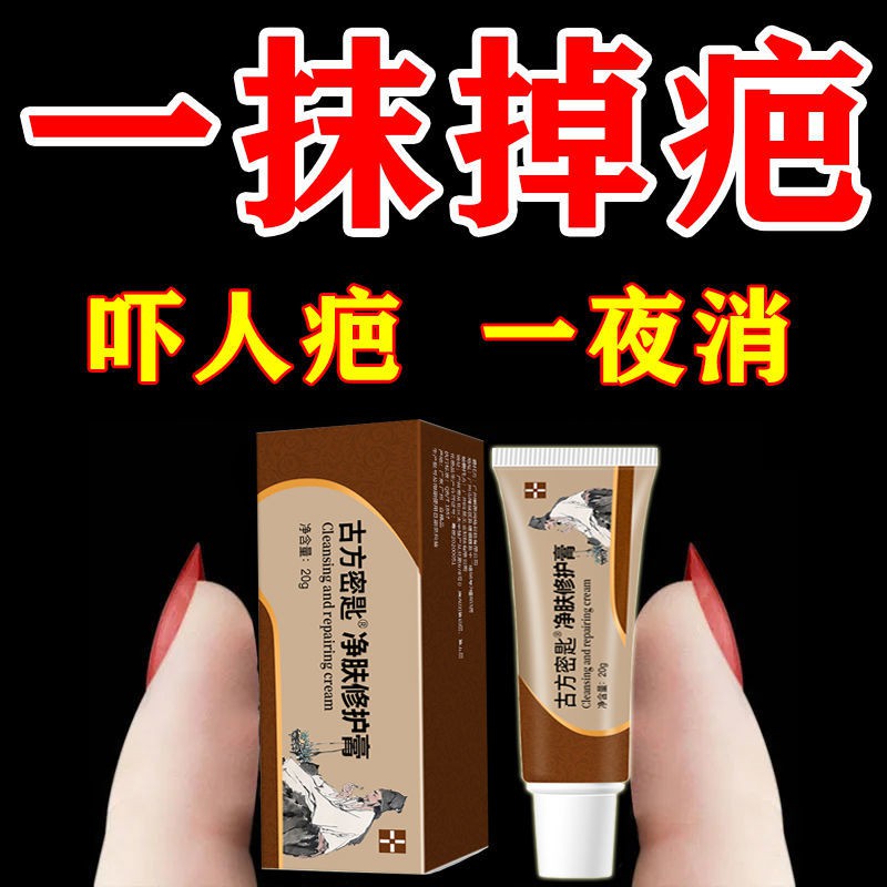 8小时消疤 不消就退 去疤膏修复无痕点痣印痘印增生疤去刀伤疤 Shopee Malaysia