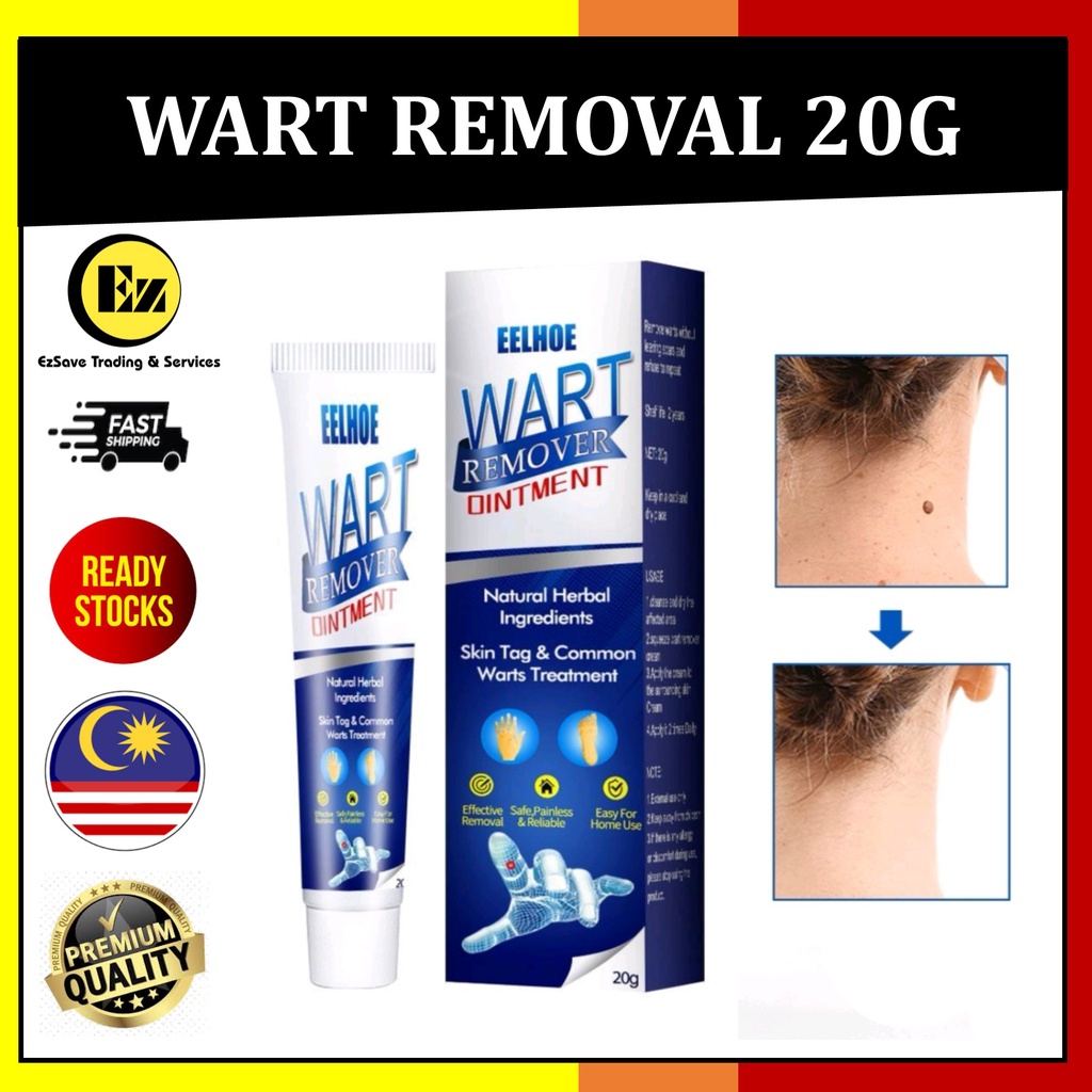 [ready Stock] 20g Corn Skin Tag Warts Remover Ointment Wart Cream For