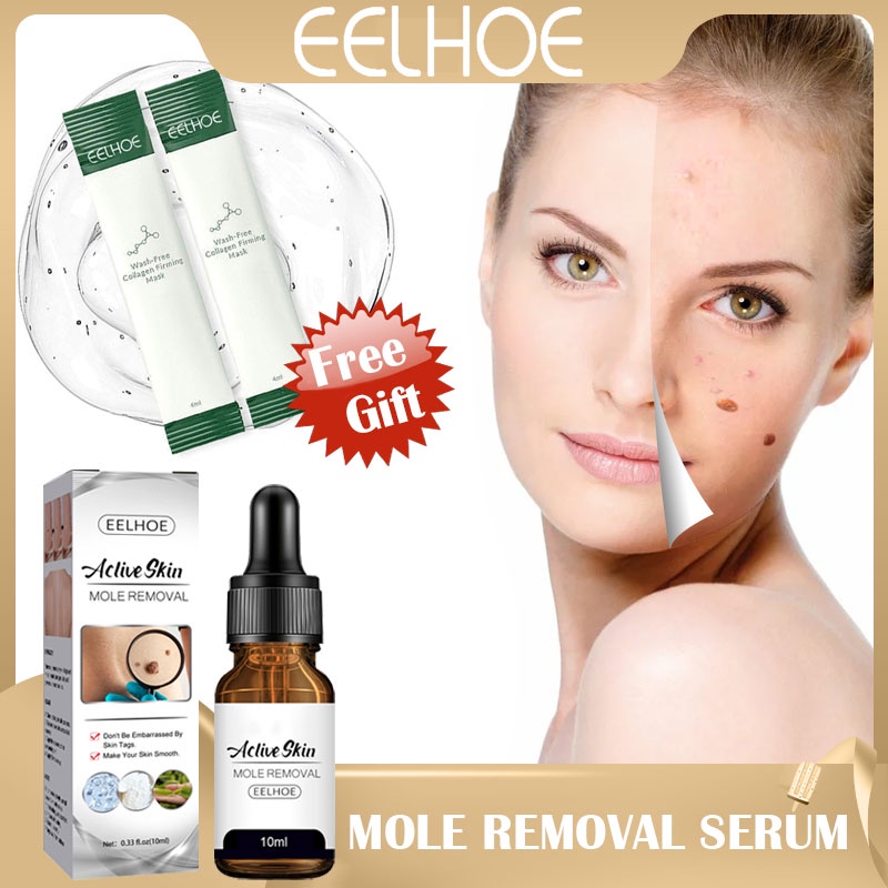 Eelhoe Aclive Skin Mole Removal Essence Salicylic Acid Remove Wart ...