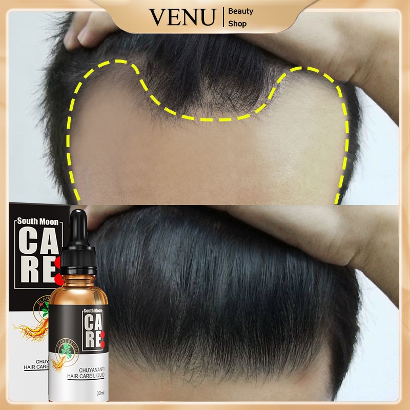 Hair Care Essential Oil AntiHair Loss Hair Growth Serum For Thinning