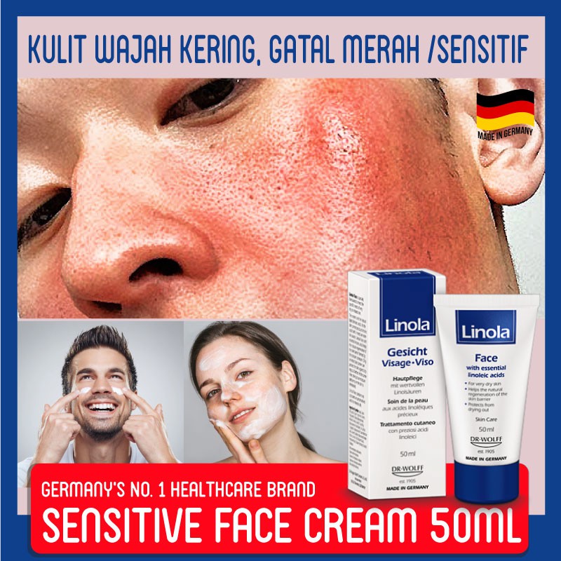 Linola Man Sensitive Face Cream For Dry Itchy Irritated Facial Skin Krim Rawat Kulit Wajah Radang Kering Gatal Lelaki Shopee Malaysia