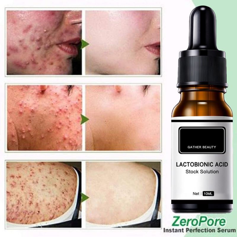 lactobionic acid essence