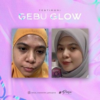 Membeli Gebu Glow Jb Vitamin C Wawawien Beaute Original Dengan Harga Istimewa Rm 119 70 Mem Beli Murah