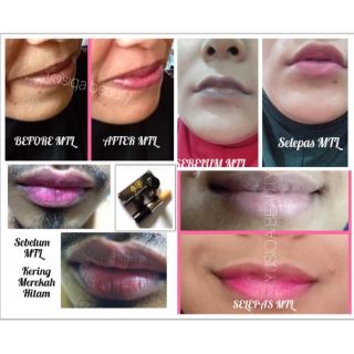 Lip Balm Magic Treatment Lips Merawat Masalah Bibir Changing Up Moisturizer Lips