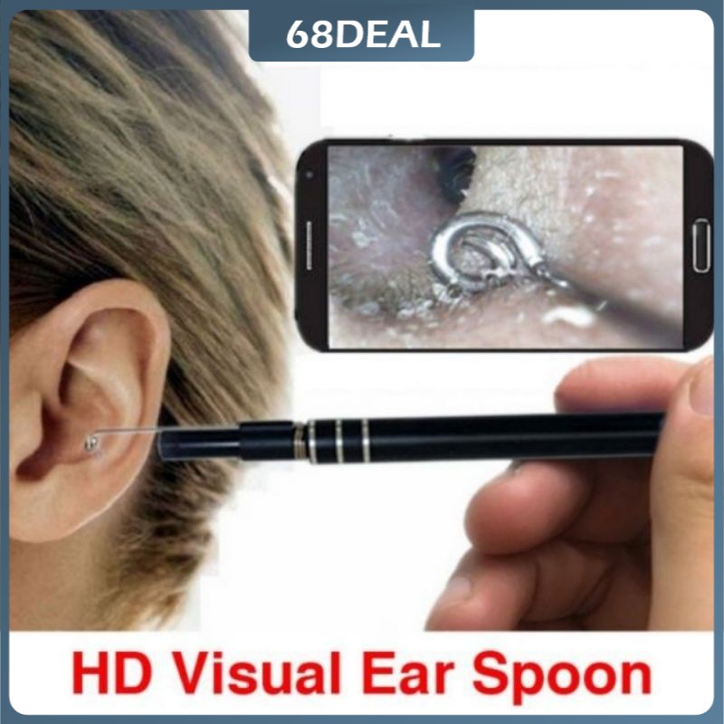 【Johor Stock】S&S Multifunction HD Ear Spoon Cleaning Endoscope Ear Cleaner Removal USB/Android/Type-c With Mini Camera