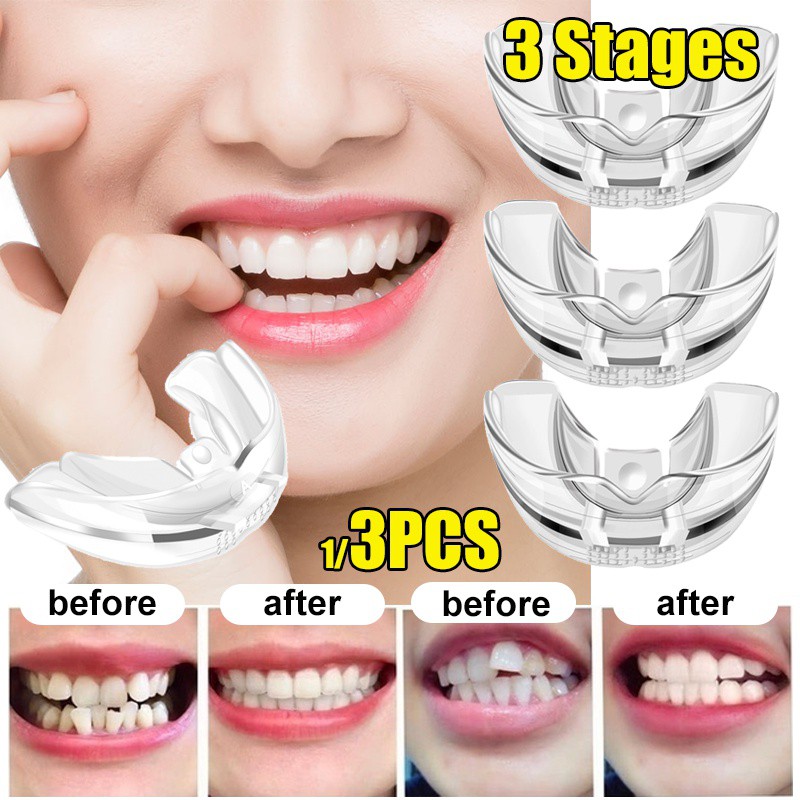 3Pcs/ Set Dental Tooth Orthodontic Appliance Trainer Dental Braces