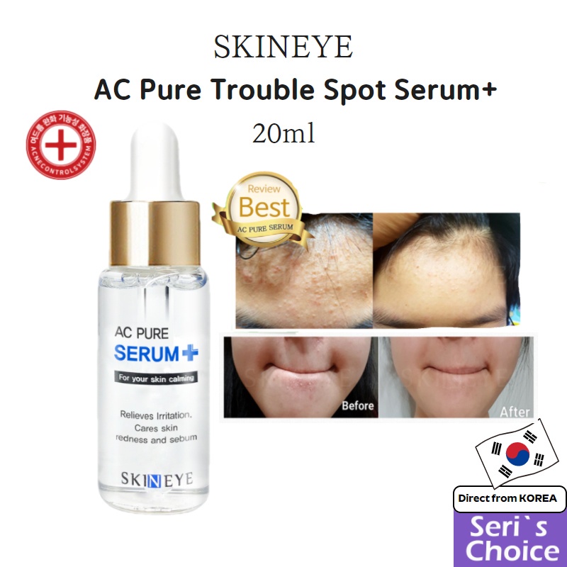 Made in Korea [Skineye] AC Pure Serum + 20ml / Trouble Spot Serum / Millet Acne & pimple scar