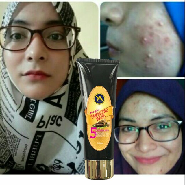 Ready Stock Magic Tamarind Mask Masker Asam Jawa Shopee Malaysia