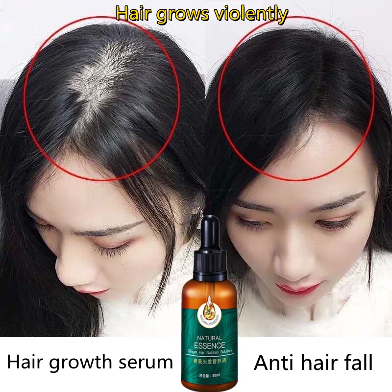 Hair Growth Serum Fast Hair Growth Essential Oil serum rambut gugur Ginger  Oil Hair Growth hair loss supplem Oil Control | Shopee Malaysia