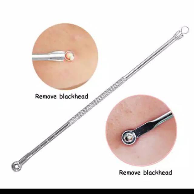 Acne tweezers or acne tweezers
