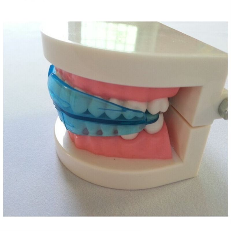 Ada masalah gigi tak selari?use this>pendakap gigi mudah guna>very cheap>value for money>suitable for everyone>comfort