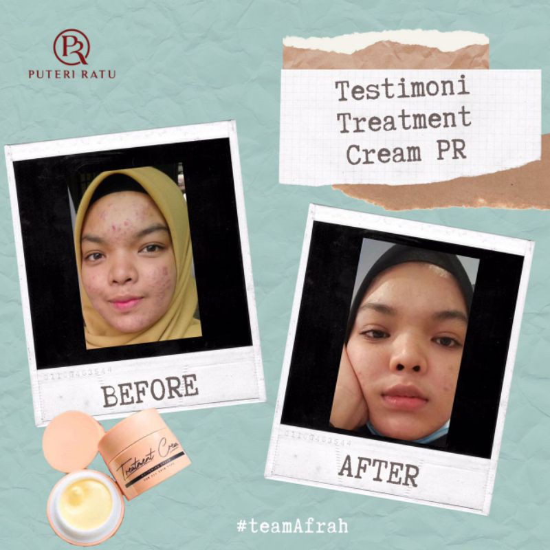 Buy Puteri Ratu Skincare Mencari Agent Master Agent Original Hq Seetracker Malaysia