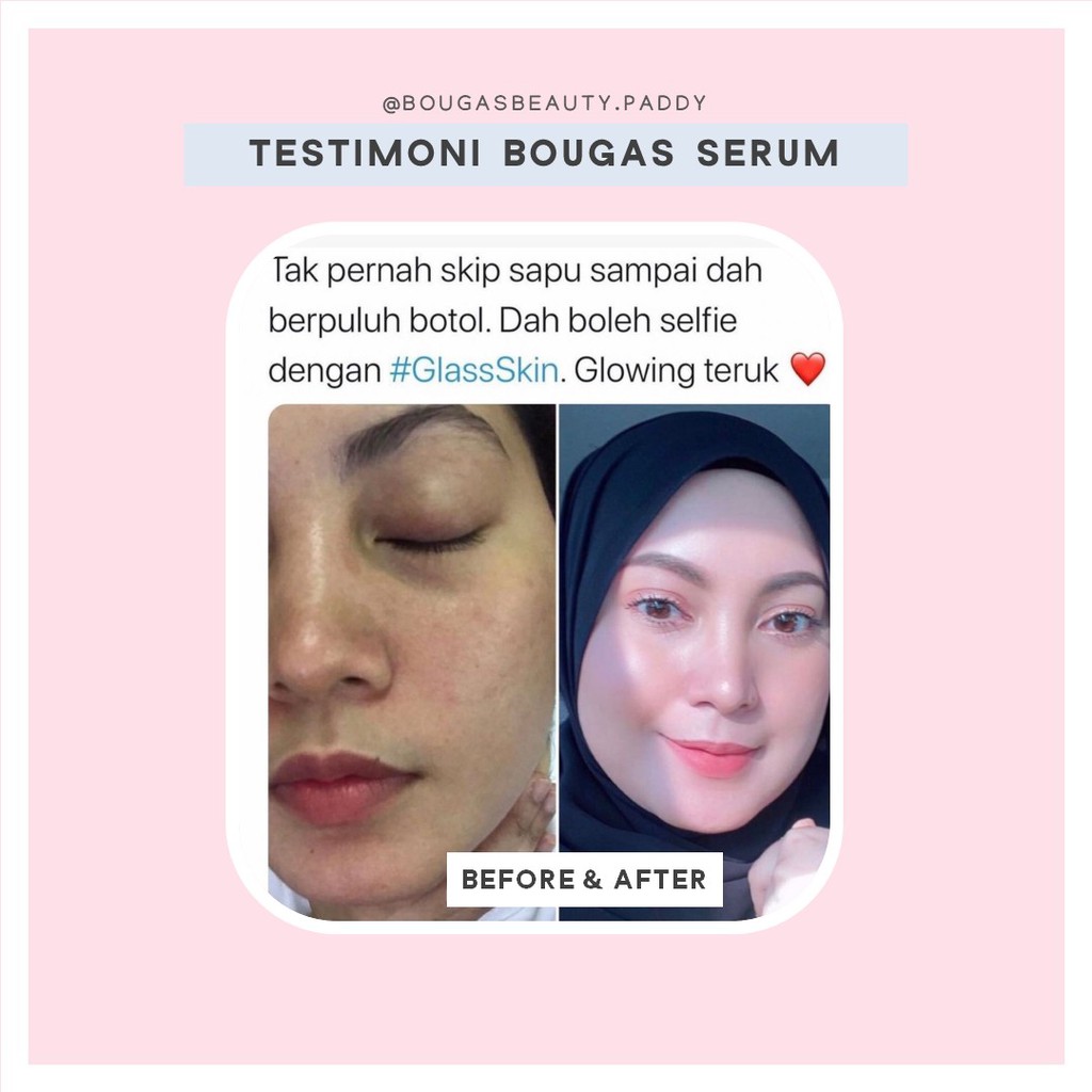 Ready Stock Bougas Serum Bougas Beauty Advanced Serum 20ml Shopee Malaysia