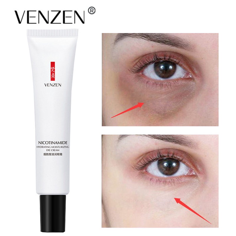 Nicotinamide Eyes Cream Whitening Dark Circles Remove Eye Bags Under