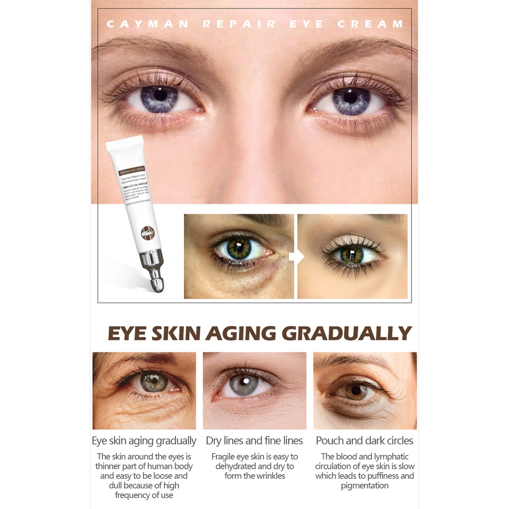 under eye pigmentation cream