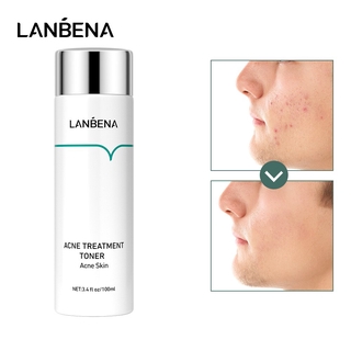 LANBENA Acne Treatment Toner Soothe The Skin,Enhancer Skin Vitality,Repair Acne Skin Deep Hydration Skincare 100ml