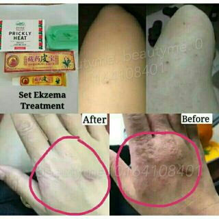 ESW EXTRA SKIN WHITE (PENCERAH MUKA, PEMUTIH KULIT, UBAT 