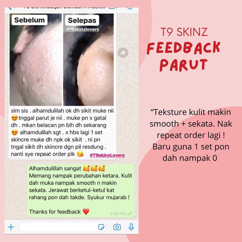 RAWATAN PARUT BERLUBANG ORGANIK  Shopee Malaysia