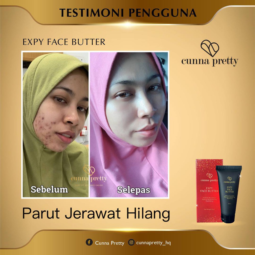 Buy Cunna Pretty Expy Face Butter 5 Free Gift Kulit Jeragat Parut Kusam Kering Jerawat Batu Seetracker Malaysia