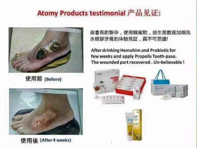 Atomy Hemohim Plus Supplement Shopee Malaysia