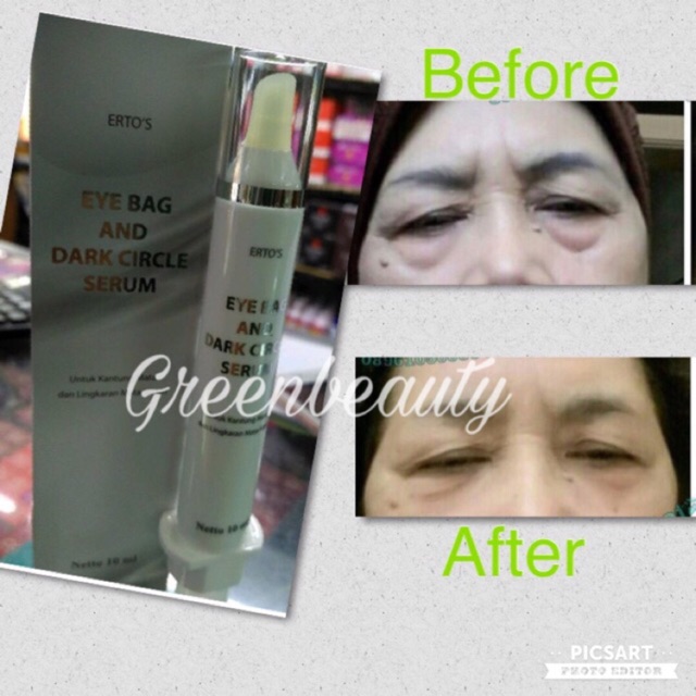 ertos eye bag and dark circle serum