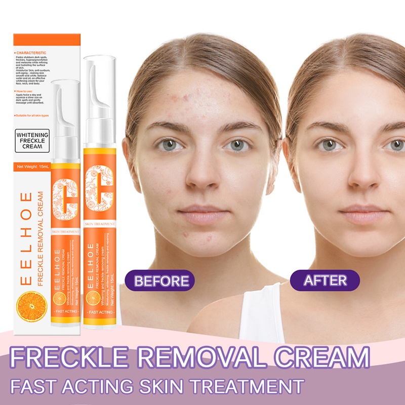 EELHOE Instant Blemish Removal Gel VC Whitening Freckle Cream Brighten