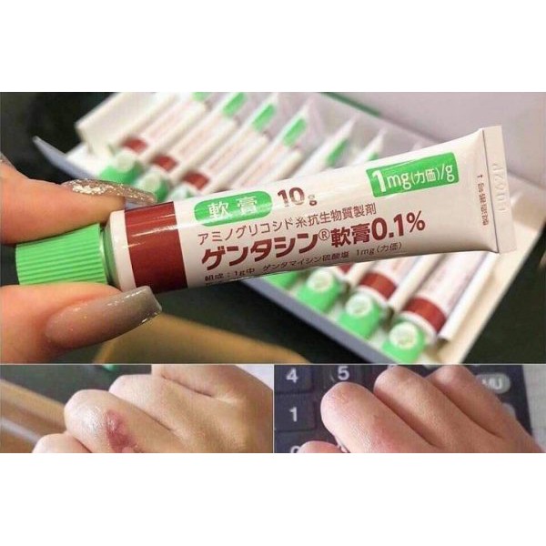 Gentacin Japanese scar cream Shopee Malaysia