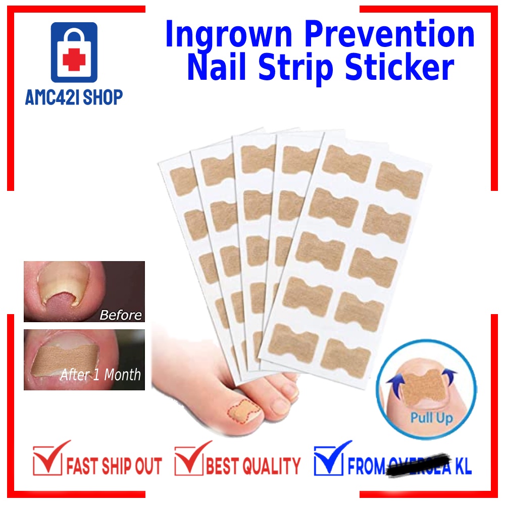 10 PCS AMC Ingrown Toenail Correction Stickers, Elastic Patch Curved