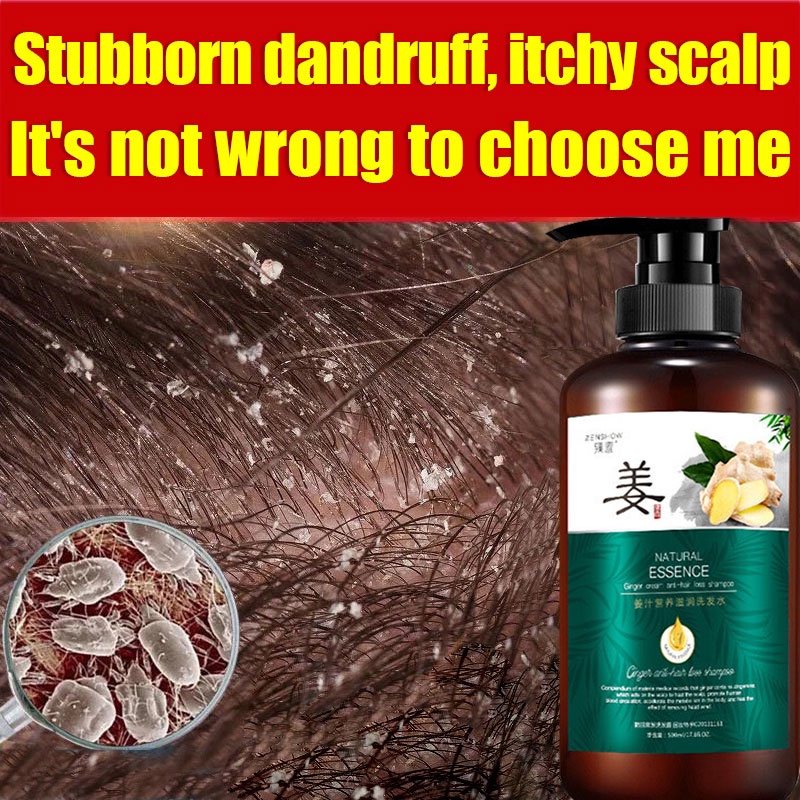 shampoo Anti-dandruff Refreshing Oil Control hilangkan kelemumur ubat ...