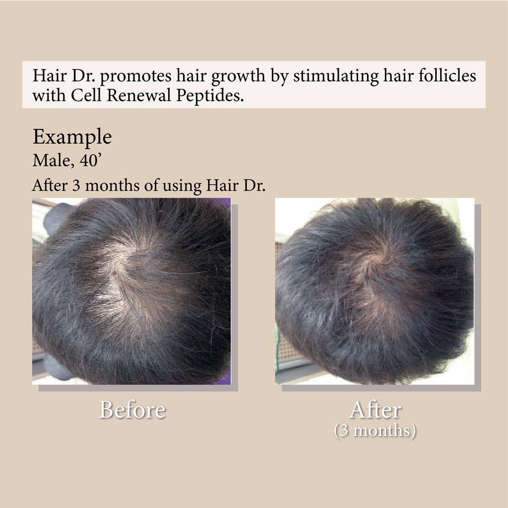 NSC] Hair Dr Anti Hair Loss Set | Shopee Malaysia