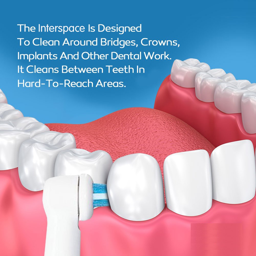 oral interspace