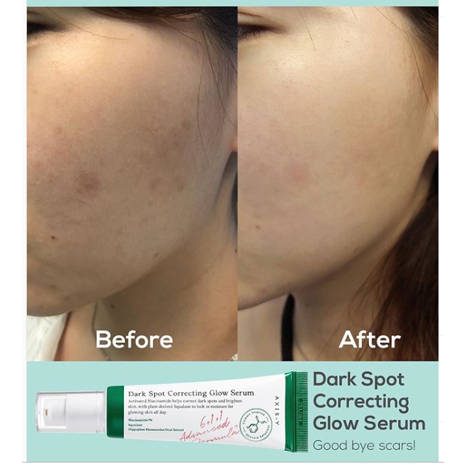 dark spot correcting glow serum watson