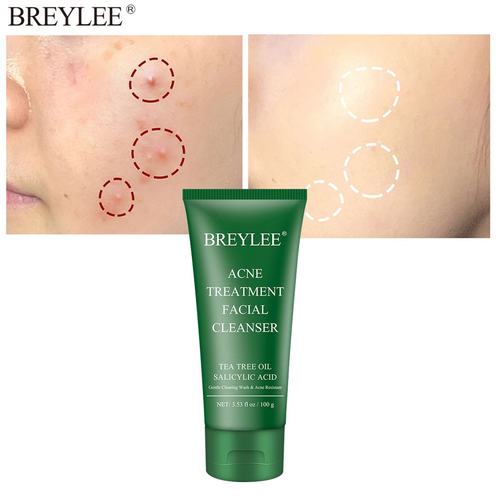 breylee acne treatment facial cleanser