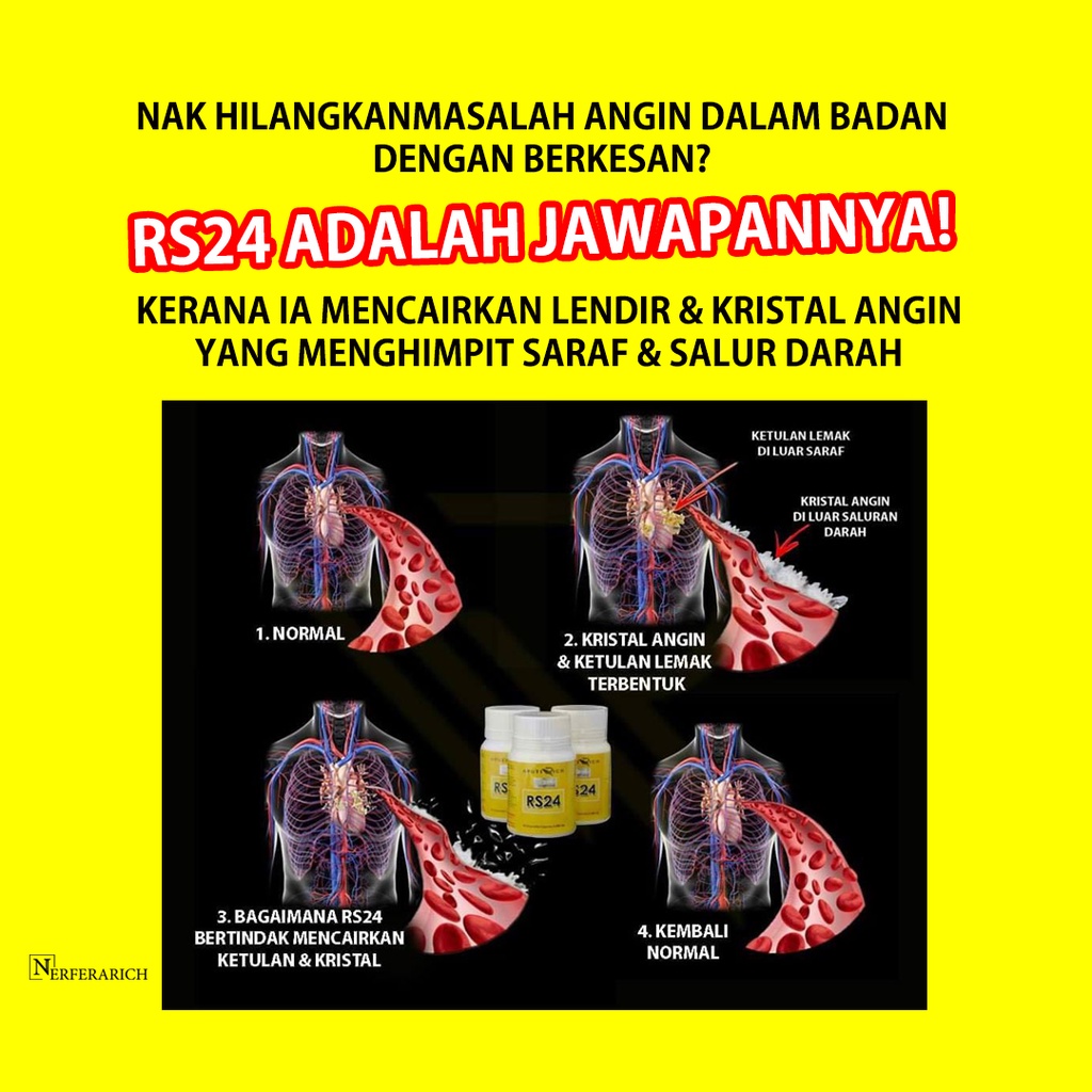 Rs24 Untuk Masalah Angin Berlebihan Dalam Badan Gastrik Gerd Pedih Ulu Hati Sakit Dada Shopee Malaysia