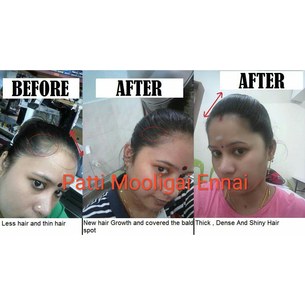 Patti Mooligai Hair Oil | Shopee Malaysia
