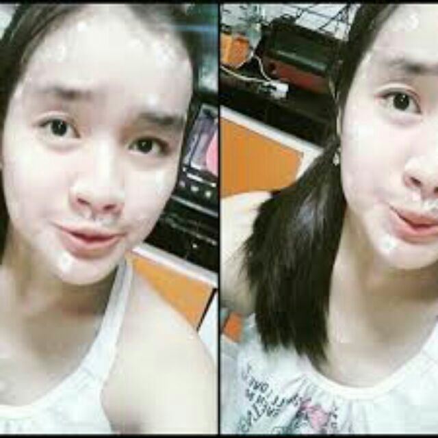 katialis cream for pimples