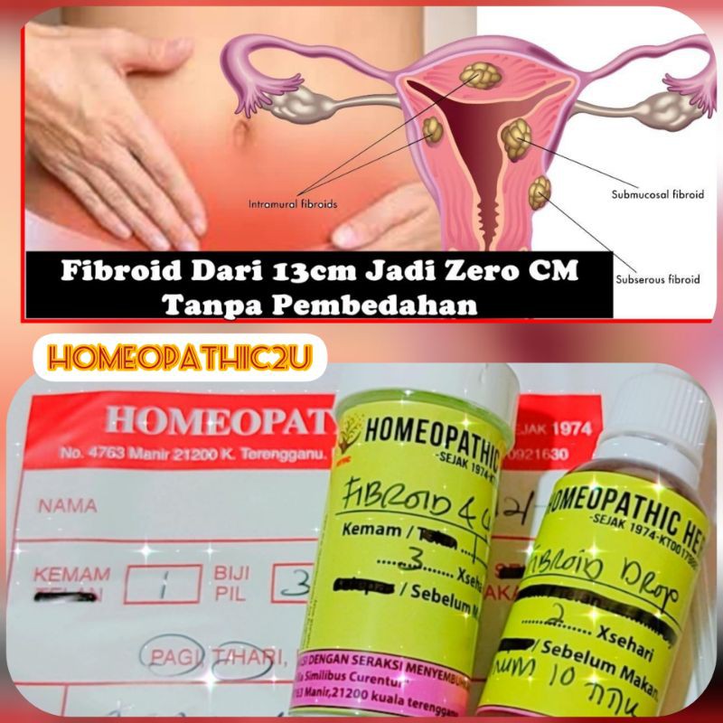 Pill Fibroid Cyst Homeopathy Shopee Malaysia