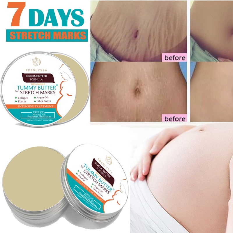 Stretch Marks And Scar Removal Maternity Skin Body Repair Cream Remove Care Products 10g 20g 30g 40g