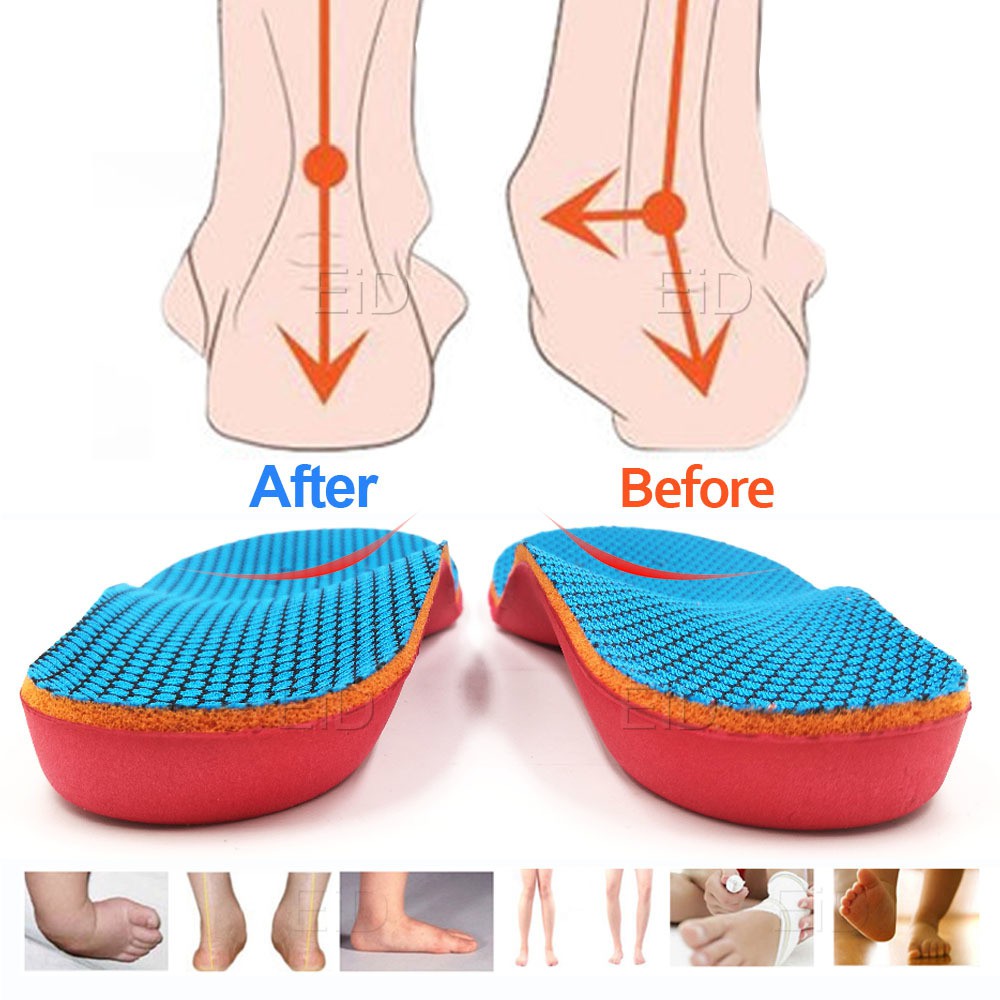 Kids Children Orthopedic Insoles Shoes Flat Foot Arch Support insoles