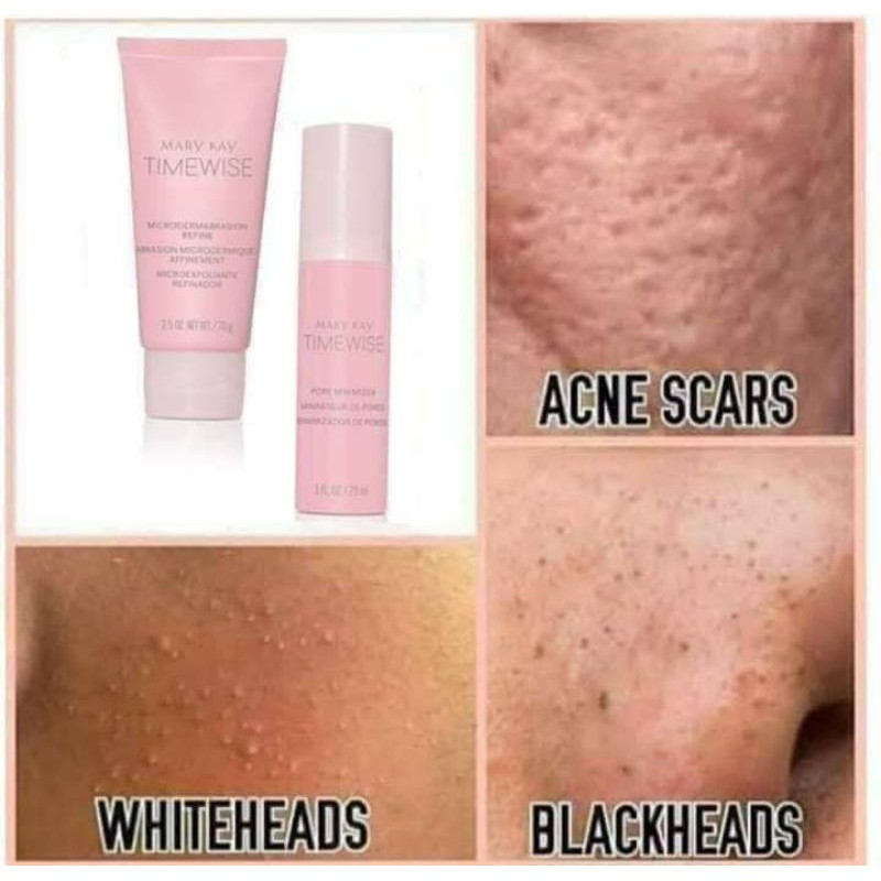 Microdermabrasion mk ready stock | Shopee Malaysia