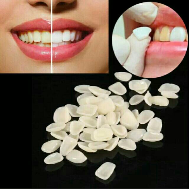teeth covering resin teeth, instant teeth cover Shopee Malaysia