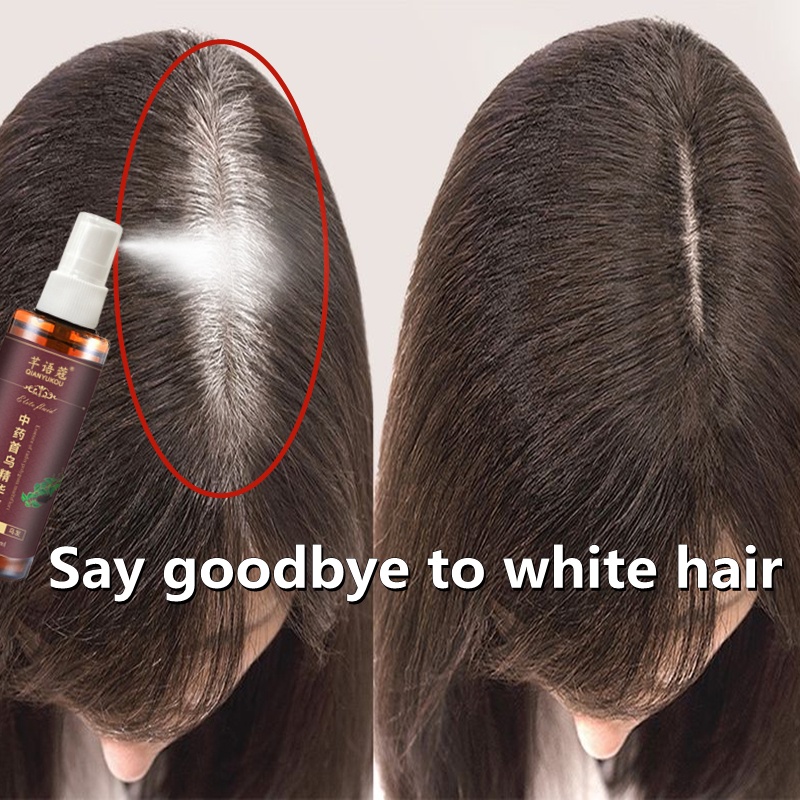 Black hair spray White Hair Turn Black Polygonum Multiflorum Essence anti White  hair Scalp Treatment Anti Hair Lost | Shopee Malaysia
