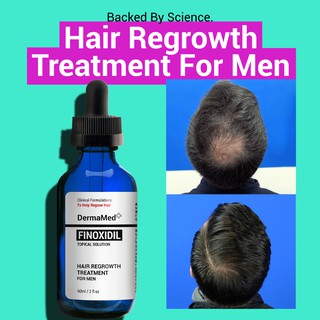 Buy Biotin Plus Shampoo Egcg 10 Root Stimulator Stronger Hair Growth Anti Hair Loss Seetracker Malaysia