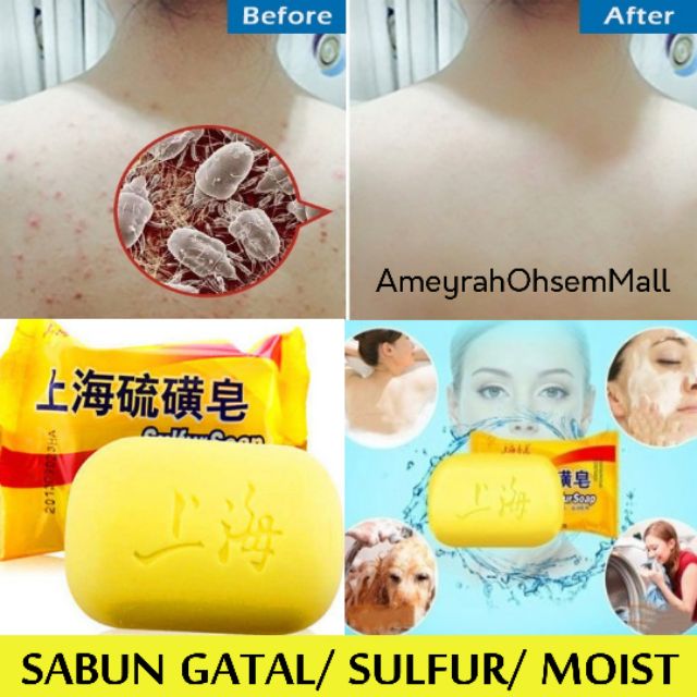 Sabun Gatal/ Berjerawat/ Ezcema/ Rambut Berkutu  Shopee 