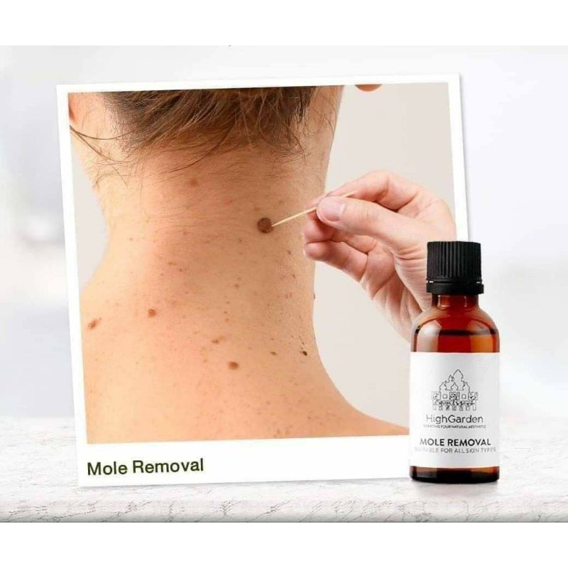 High Garden Mole Removal Offical Product (FDA APPROVED !) | Shopee Malaysia