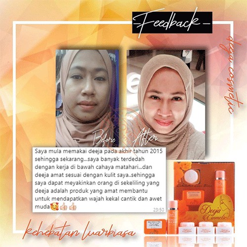 Original Deeja Cosmetic Free Gift Kulit Putih Cantik Awet Muda Rawat Jerawat Jeragat Kulit Kusam Kedutan Shopee Malaysia