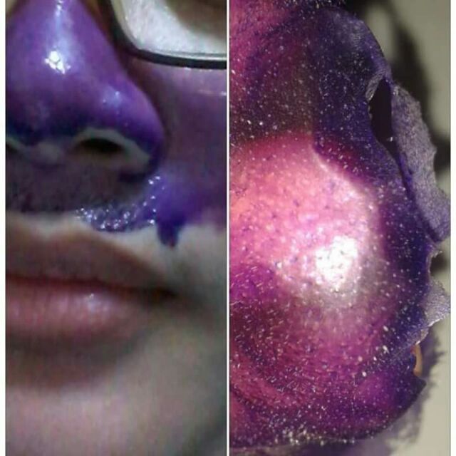 Flora Mask Hilangkan Blackhead Dan Whitehead Sales Shopee Malaysia