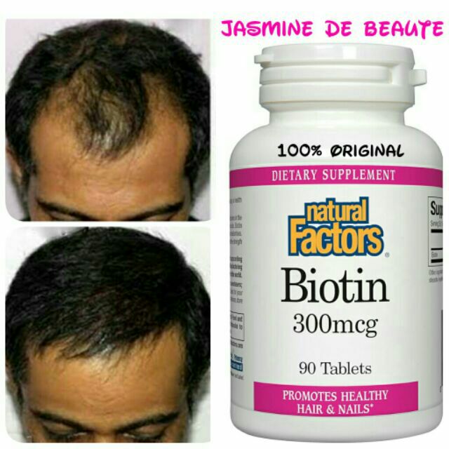 Biotin for Hair & Nails (Hair Loss/Rambut Gugur/Botak/Hair Growth) | Shopee  Malaysia